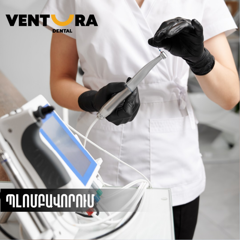 վենտուրա դենտալ ստոմատոլոգիական կլինիկա